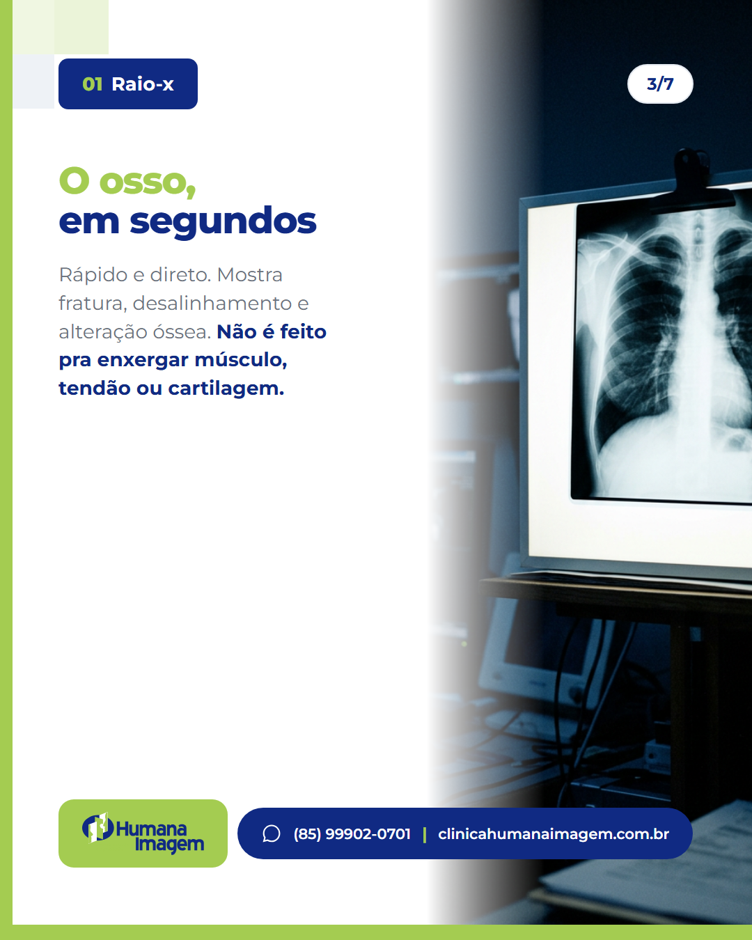 Slide 3 de 7